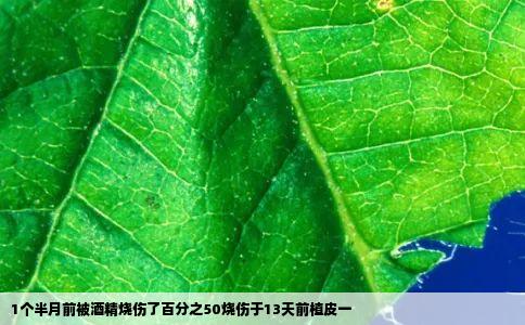 1个半月前被酒精烧伤了百分之50烧伤于13天前植皮一