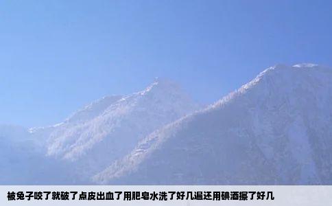 被兔子咬了就破了点皮出血了用肥皂水洗了好几遍还用碘酒擦了好几