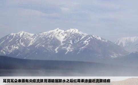 耳洞耳朵表面有炎症流脓用酒精擦脓水之后红霉素涂最近流脓结痂