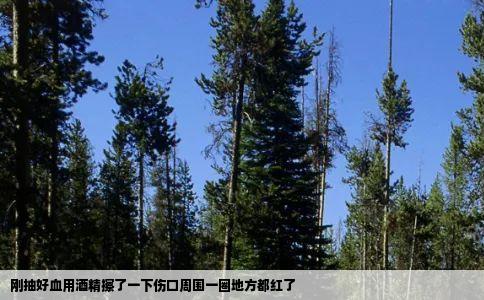 刚抽好血用酒精擦了一下伤口周围一圈地方都红了