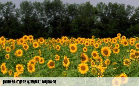 j酒后起红疹吃东西要注意哪些吗