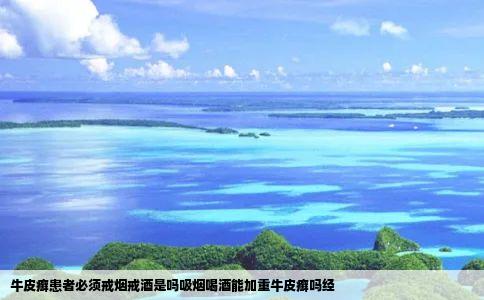 牛皮癣患者必须戒烟戒酒是吗吸烟喝酒能加重牛皮癣吗经
