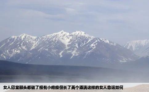 女人印堂额头都破了相有小疤痕但长了两个酒涡这样的女人命运如何