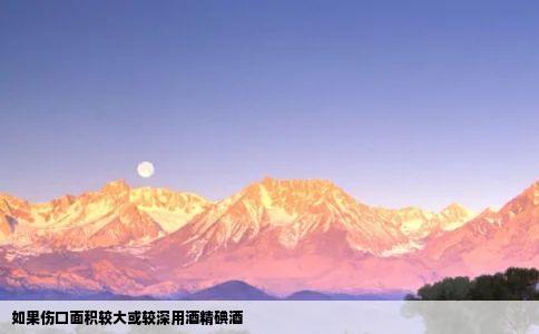 如果伤口面积较大或较深用酒精碘酒