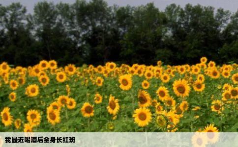 我最近喝酒后全身长红斑