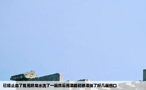 已经止血了我用肥皂水洗了一遍然后用酒精和碘酒抹了好几遍伤口